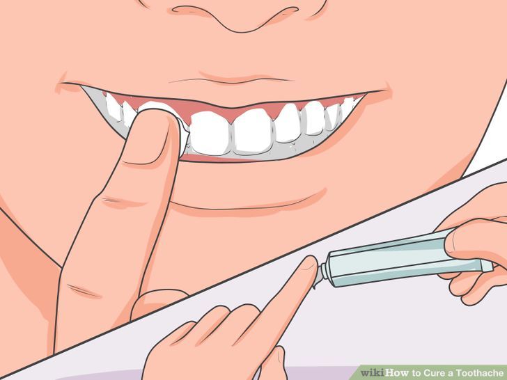 teeth whitening gel wiki
