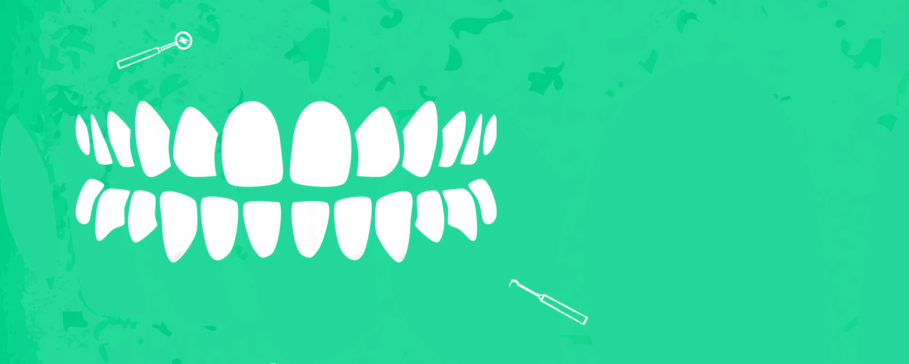 Full-mouth Rehabilitation