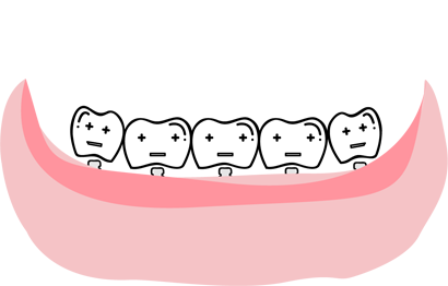 Arudhra Dental Care - Implants