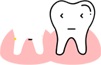 Missing Tooth